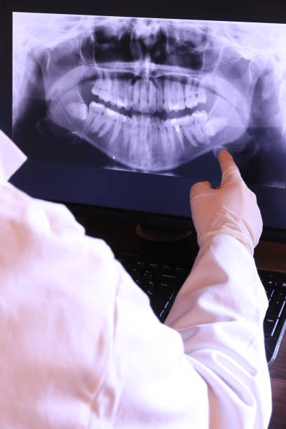 Best Emergency Wisdom Teeth Removal in Hondo, TX
